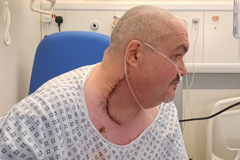 Latest News: Frank showing his scar from his operation